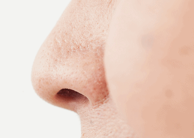 鼻・隆鼻術　美容コラム2　1枚目の画像